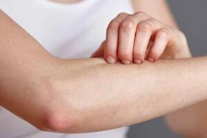 Những bệnh da liễu thường gặp trong mùa nồm và cách phòng tránh