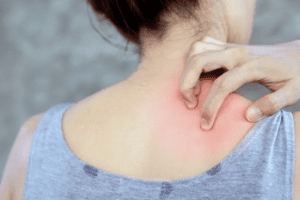 3 vị trí ngứa ngáy là dấu hiệu đường huyết tăng cao, bệnh tiểu đường đến rất gần: Chớ chủ quan