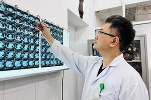 Cắt thành công bướu giáp khổng lồ nằm sâu trong lồng ngực cụ bà gần 90 tuổi