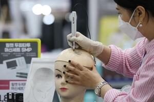 Hàn Quốc tranh cãi về bảo hiểm chi trả điều trị rụng tóc