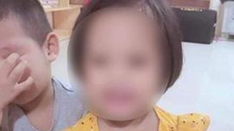 Sức khỏe bé gái 3 tuổi bị nhân tình của mẹ đóng đinh vào đầu hiện ra sao?