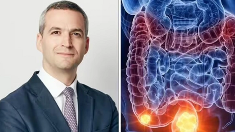 Chuyên gia ung thư đại trực tràng: Thấy 4 dấu hiệu này, hãy đi khám ngay!