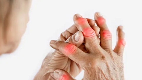 Khớp ngón tay bị sưng đau không chỉ do viêm khớp