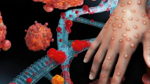 Đậu mùa khỉ không phải là dạng COVID-19 mới