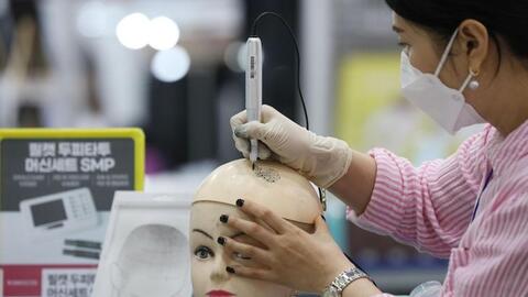 Hàn Quốc tranh cãi về bảo hiểm chi trả điều trị rụng tóc