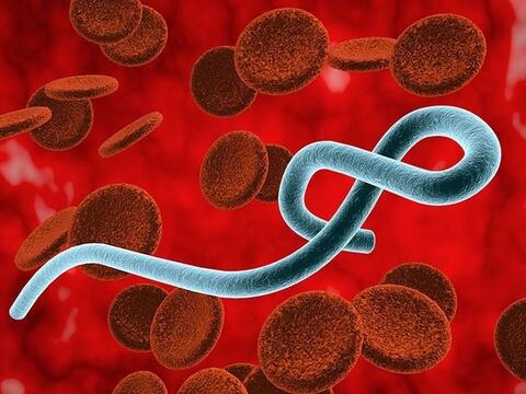 Bộ Y tế ban hành tài liệu chuyên môn hướng dẫn chẩn đoán và điều trị bệnh do virus Ebola