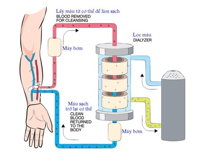 Hạn chế ăn những thứ này nếu không muốn phải chạy thận cả đời